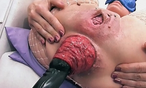 Most affecting prolapse scene! cervix, fisting, max exaggerate