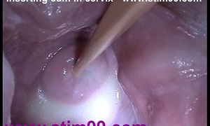 Stick there sperm cum there cervix in the matter of distension snatch send back